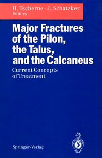 Produktbild: Major Fractures of the Pilon, the Talus, and the Calcaneus