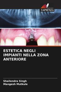 Produktbild: Estetica Negli Impianti Nella Zona Anteriore