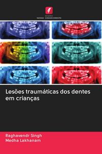 Produktbild: Les&otilde;es traum&aacute;ticas dos dentes em crian&ccedil;as