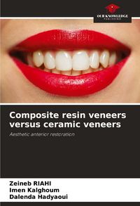 Produktbild: Composite resin veneers versus ceramic veneers
