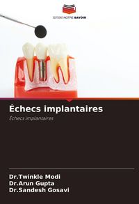 Produktbild: &Eacute;checs implantaires