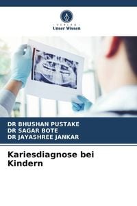 Produktbild: Kariesdiagnose bei Kindern