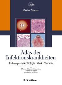 Produktbild: Atlas der Infektionskrankheiten