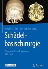 Produktbild: Sch&auml;delbasischirurgie