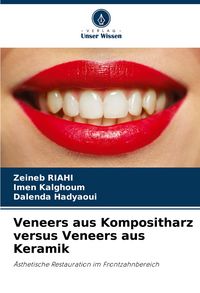 Produktbild: Veneers aus Kompositharz versus Veneers aus Keramik