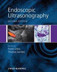 Produktbild: Endoscopic Ultrasonography