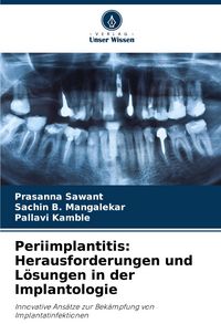 Produktbild: Periimplantitis: Herausforderungen und L&ouml;sungen in der Implantologie