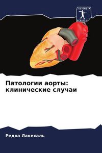 Produktbild: Patologii aorty: klinicheskie sluchai