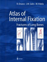 Produktbild: Atlas of Internal Fixation