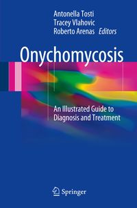 Produktbild: Onychomycosis