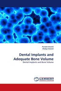 Produktbild: Dental Implants and Adequate Bone Volume