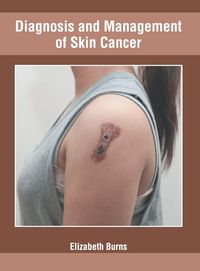 Produktbild: Diagnosis and Management of Skin Cancer