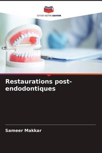 Produktbild: Restaurations post-endodontiques