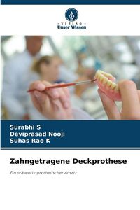 Produktbild: Zahngetragene Deckprothese