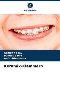 Produktbild: Keramik-Klammern
