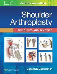 Produktbild: Shoulder Arthroplasty