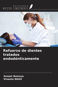 Produktbild: Refuerzo de dientes tratados endod&oacute;nticamente