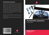 Produktbild: Periodontite agressiva