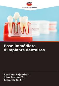 Produktbild: Pose imm&eacute;diate d'implants dentaires