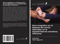 Produktbild: Gu&iacute;a ecogr&aacute;fica en el bloqueo del nervio obturador en la espasticidad de miembros inferiores
