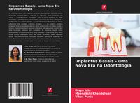 Produktbild: Implantes Basais - uma Nova Era na Odontologia