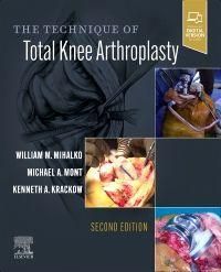 Produktbild: The Technique of Total Knee Arthroplasty