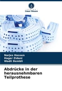 Produktbild: Abdr&uuml;cke in der herausnehmbaren Teilprothese