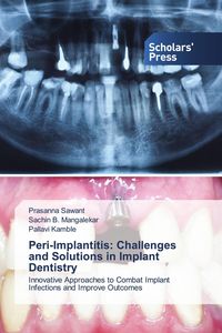 Produktbild: Peri-Implantitis: Challenges and Solutions in Implant Dentistry