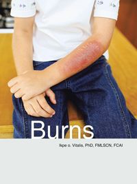 Produktbild: Burns