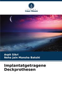 Produktbild: Implantatgetragene Deckprothesen