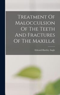 Produktbild: Treatment Of Malocculsion Of The Teeth And Fractures Of The Maxill&aelig;