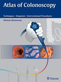Produktbild: Atlas of Colonoscopy