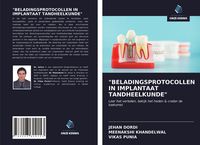 Produktbild: "beladingsprotocollen in Implantaat Tandheelkunde"