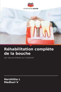 Produktbild: R&eacute;habilitation compl&egrave;te de la bouche