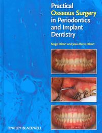 Produktbild: Practical Osseous Surgery in Periodontics and Implant Dentistry