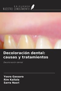 Produktbild: Decoloraci&oacute;n dental: causas y tratamientos