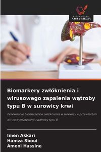 Produktbild: Biomarkery zw&iquest;&oacute;knienia i wirusowego zapalenia w&iquest;troby typu B w surowicy krwi