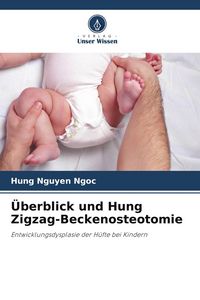 Produktbild: &Uuml;berblick und Hung Zigzag-Beckenosteotomie
