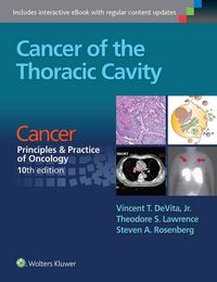Produktbild: DeVita, V: Cancer of the Thoracic Cavity