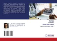 Produktbild: Basal Implants