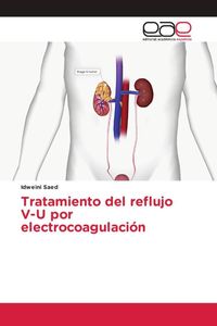 Produktbild: Tratamiento del reflujo V-U por electrocoagulaci&oacute;n