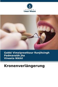 Produktbild: Kronenverl&auml;ngerung