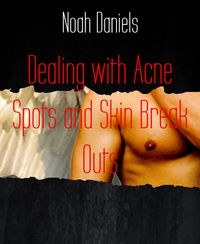 Produktbild: Dealing with Acne Spots and Skin Break Outs