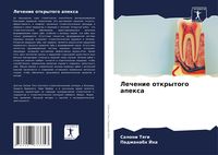 Produktbild: Lechenie otkrytogo apexa