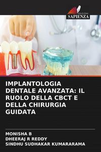 Produktbild: IMPLANTOLOGIA DENTALE AVANZATA: IL RUOLO DELLA CBCT E DELLA CHIRURGIA GUIDATA