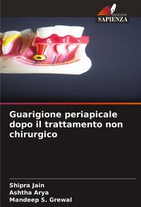 Produktbild: Guarigione periapicale dopo il trattamento non chirurgico