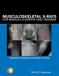 Produktbild: Musculoskeletal X-Rays for Medical Students and Trainees