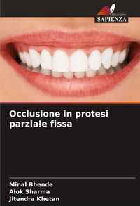Produktbild: Occlusione in protesi parziale fissa