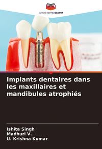 Produktbild: Implants dentaires dans les maxillaires et mandibules atrophi&eacute;s