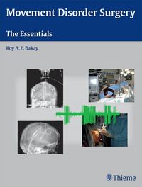 Produktbild: Movement Disorder Surgery